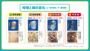 ４